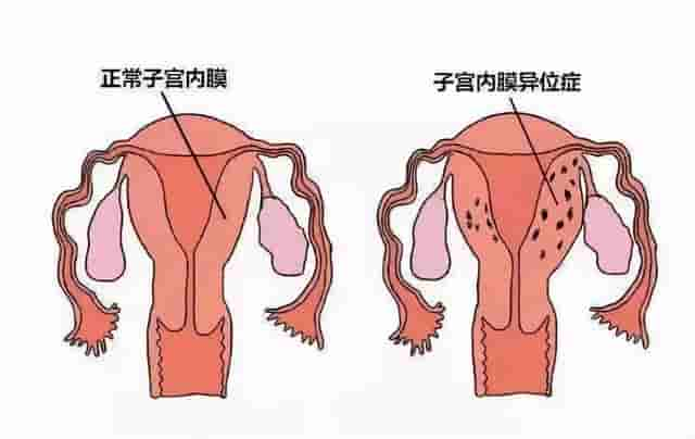 第一次胚胎着床失败后，能做些什么？