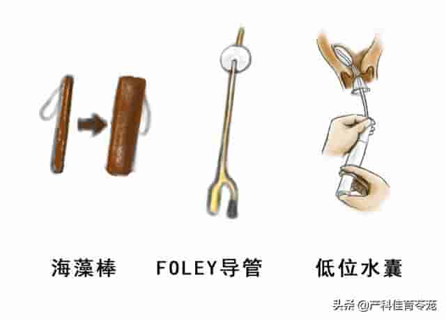 都是生孩子，为啥她点催产素，我要放药？