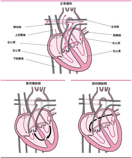 呼吸异常，注意心肺疾病