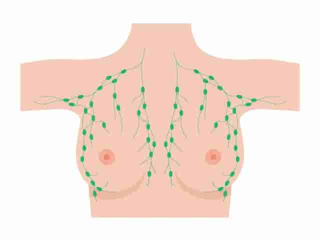 乳房出现5个变化，不是大病就是癌！男女没事要常摸常看，别拖到晚期才后悔