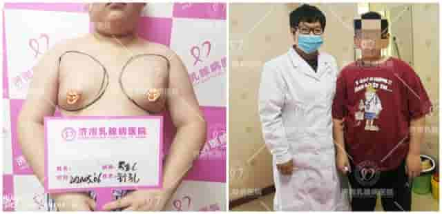 济南乳腺病医院：青春期孩子的家长注意！合理饮食谨防男乳发育