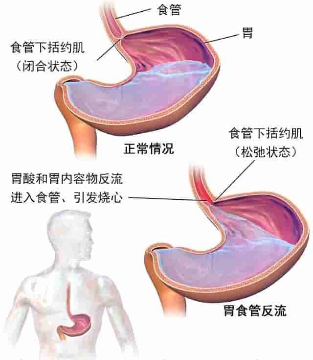 吃完饭就躺下会有什么后果？除了发胖，还有这4大危害