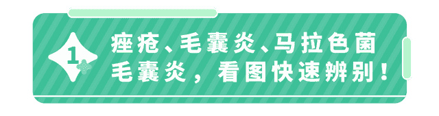 痤疮or毛囊炎？孩子身上这种痘到底是啥？一张图帮你分辨