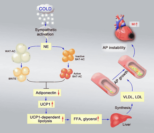 世界心脏日｜一项持续百年的科学探索：寒冷如何诱发心血管疾病