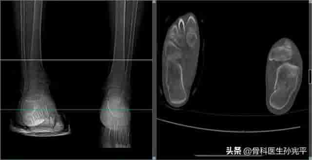 医学影像图片共分享（六）