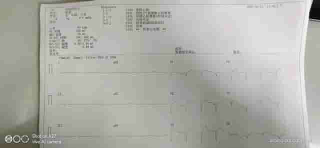 不可思议：因咳嗽而住院没想到竟然是心梗，常规检查有多重要？