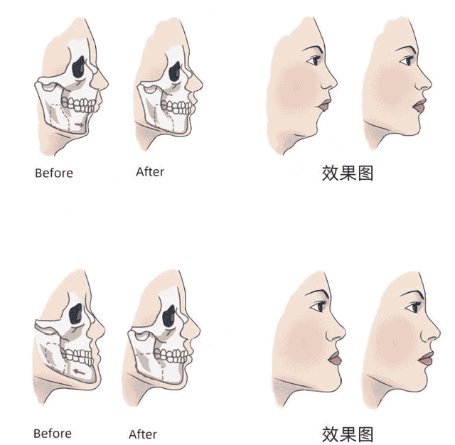 颌面发育异常都有哪些症状表象