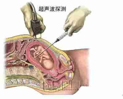 【干货】解剖图，这么全，不留用后悔啊！