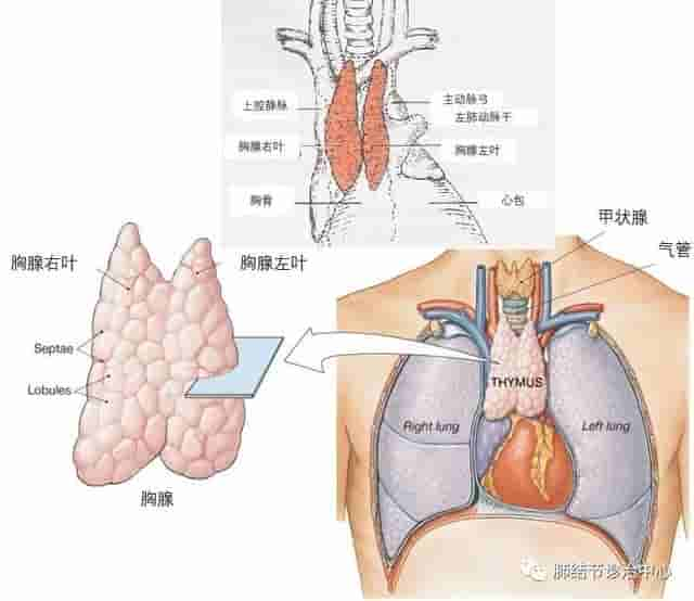 从眼睛睁不开到呼吸困难，重症肌无力有多可怕？