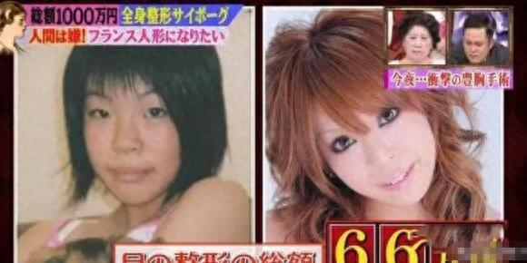 日本女子花费1000万元整容50次，从丑女蜕变成为“大美女”