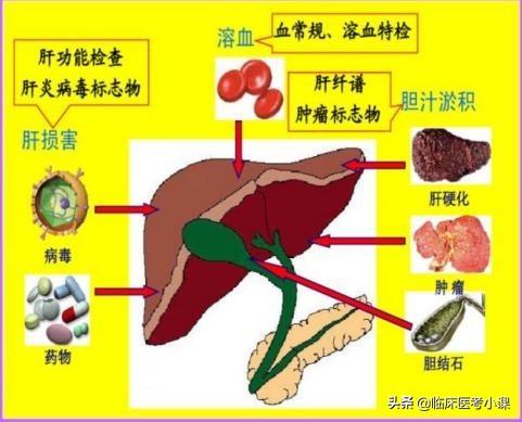 检体诊断学—常见症状：黄疸