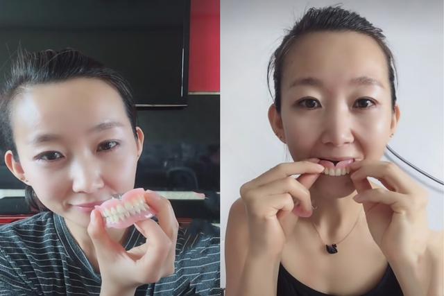 美女因病被迫拔光满嘴牙齿后自嘲：拿掉假牙，咱是最年轻的老太太